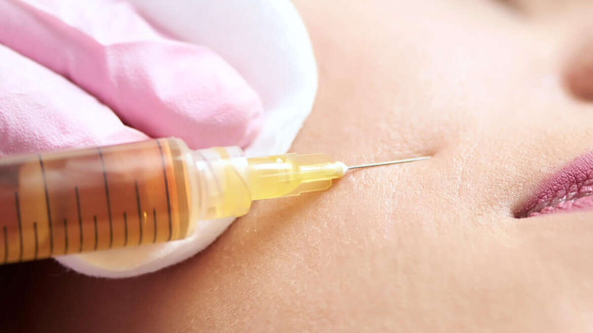 1200-1475-PRP-Face-PRP-2-1-1170×658